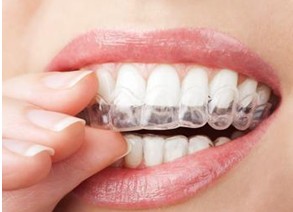 透明牙齿矫正需要多久时间