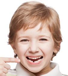 儿童哨牙矫正