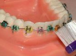 牙石萎缩还能做牙齿矫正吗？