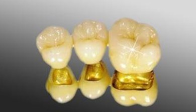 牙齿缺失及时修复的方法