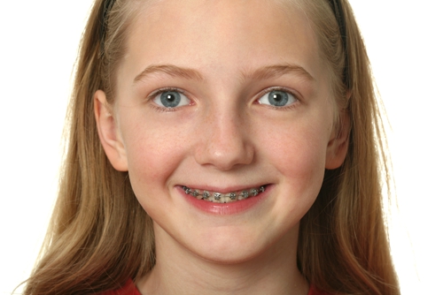 儿童牙齿矫正越早越好吗？