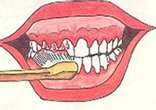 刷牙时牙龈出血是什么原因？