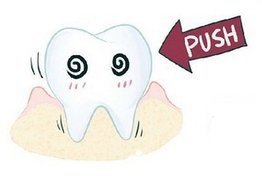 牙齿松动有哪些表现？