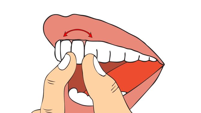儿童牙齿松动是怎么一回事？