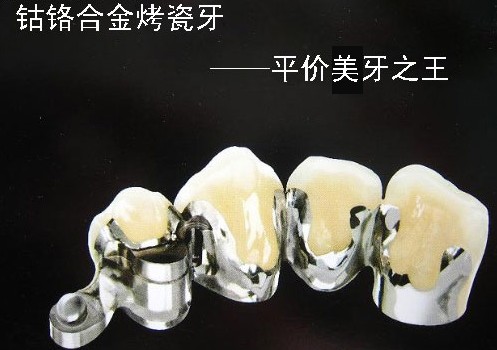 钴铬合金烤瓷牙对人体有危害吗？