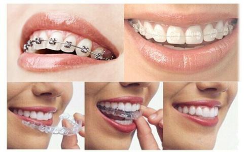 哪些情况会造成牙齿矫正后复发？