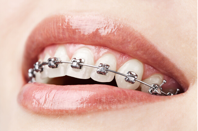 矫牙后会导致牙齿过早脱落吗？