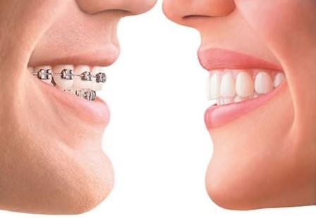 牙齿矫正后的日常护理要怎么做？