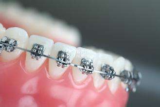 牙齿矫正要戴多久的矫治器？