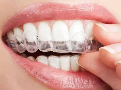 牙齿矫正有风险吗？