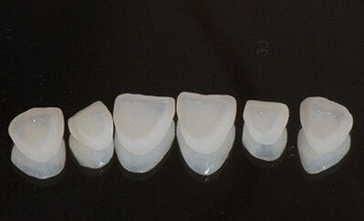 牙齿贴面适用于哪些人群？