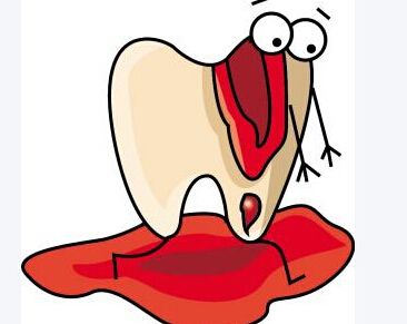 深圳牙龈出血怎么办？