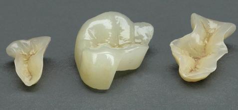 深圳牙齿缺损如何治疗？