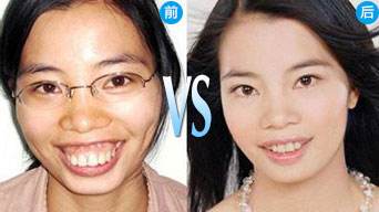 想矫正龅牙，哪家口腔医院效果比较好？