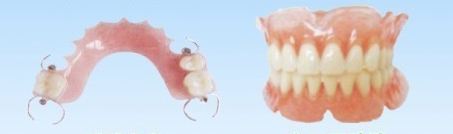 活动假牙种类有哪些？
