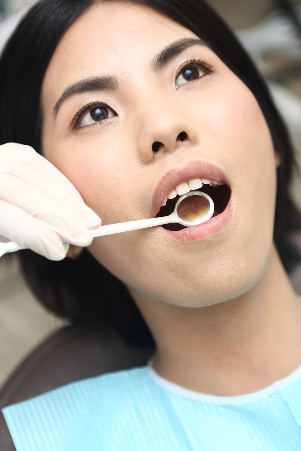 做活动假牙一般需要多少钱？