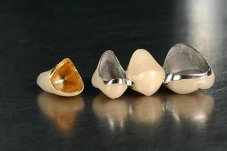 装一个烤瓷牙多少钱? 装一个烤瓷牙多少钱?
