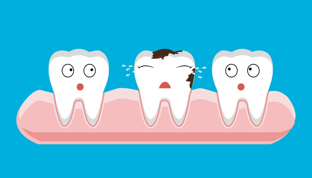 树脂补牙能维持多久？深圳树脂补门牙缝多少钱一颗？