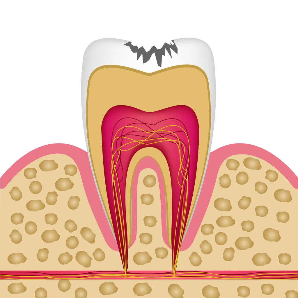 补牙需要多长时间？深圳补牙齿可以用医保吗？