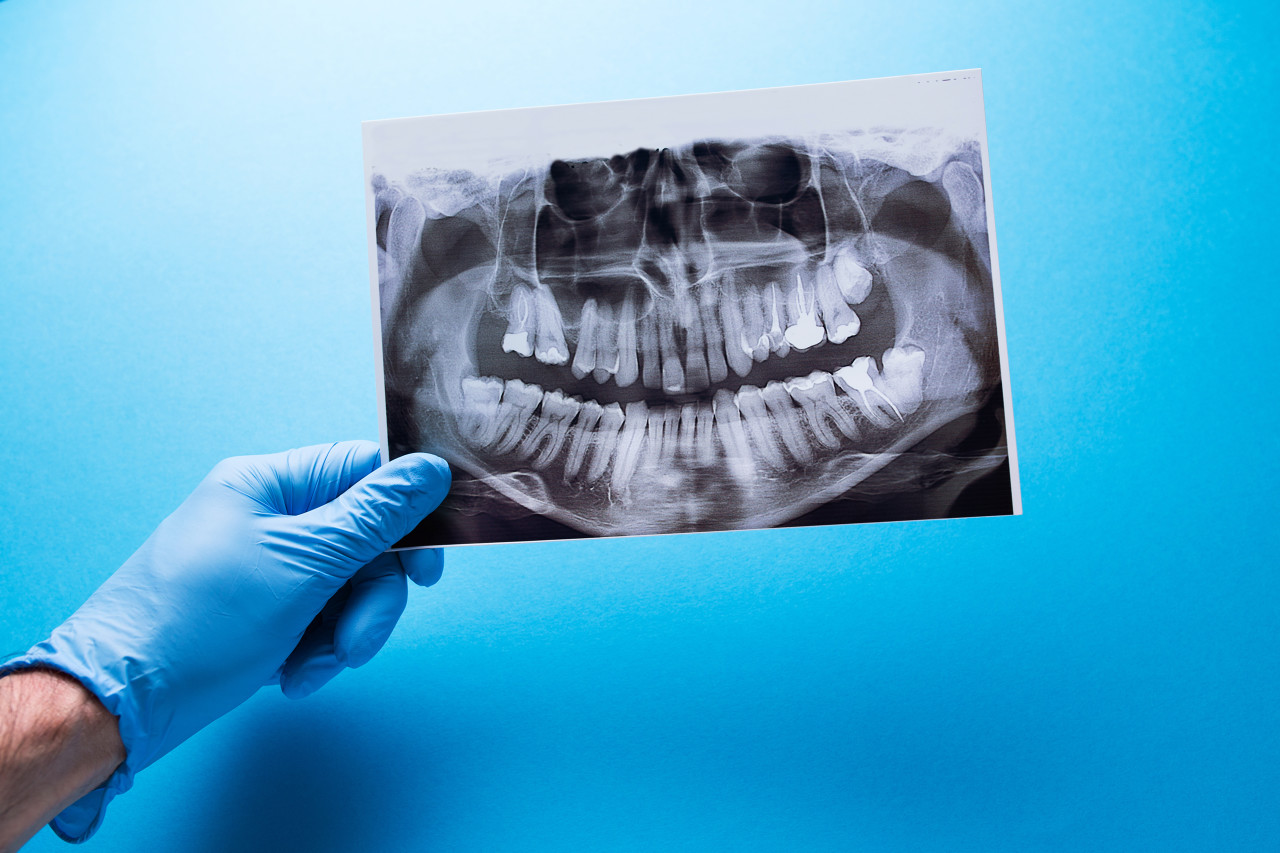 种植牙对人体有哪些伤害？比如出血。种植牙对医院的设备和医生的技术水平要求非常严格，许多因为医生的技术水平不到位，而导致种植牙之后的出血现象。对此朋友们需要注意的是，种植牙一定要选择大型医院或专业的牙科诊所。</div>
<div>