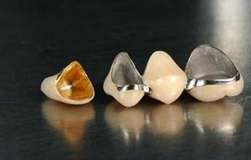 烂牙、断根、松动牙必须拔除吗? 烂牙、断根、松动牙必须拔除吗?