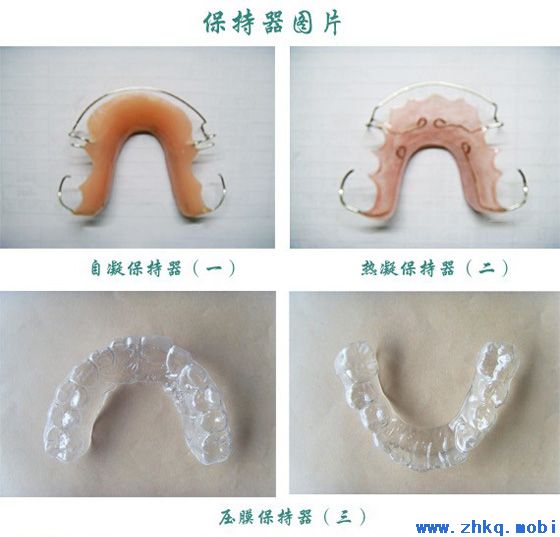 保持器的费用是多少？