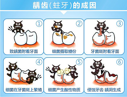 哪些因素容易引发龋齿？