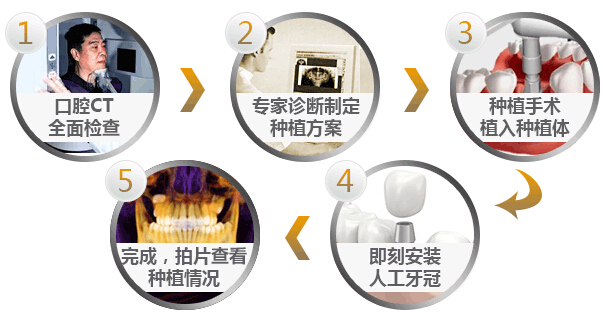 什么是即刻种植牙？