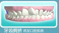牙齿拥挤的危害有哪些？