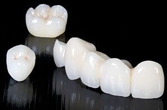 全瓷牙的价格是多少？