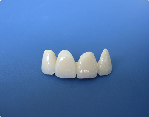 做完烤瓷牙后要注意什么？