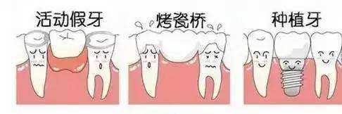 深圳镶牙齿多少钱一颗？