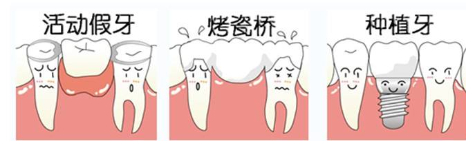 深圳镶牙齿一般要多少钱？