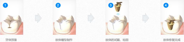 深圳牙齿缺损怎么治疗比较好？