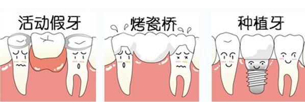 拔牙了，需要等多久才能镶牙？