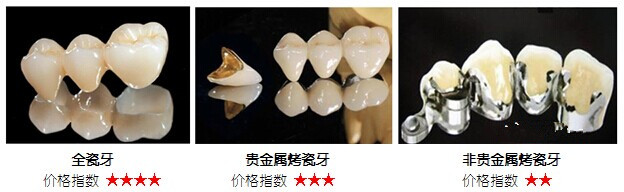 烤瓷牙和全瓷牙有什么区别？