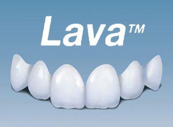 美国Lava全瓷牙好不好? 美国Lava全瓷牙好不好?