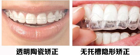 牙齿矫正多少钱啊? 牙齿矫正多少钱啊?
