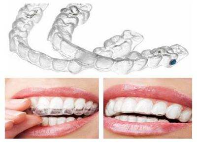 隐形正畸牙齿有没有副作用？效果怎么样？