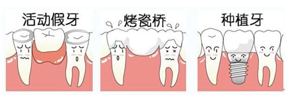 镶固定牙需要多少钱？