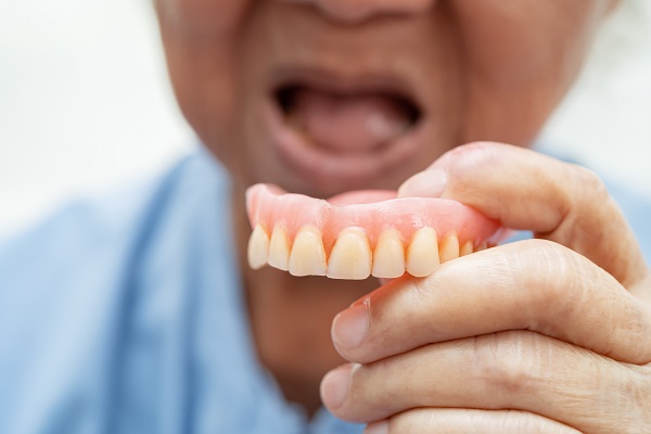 活动假牙有哪些种类