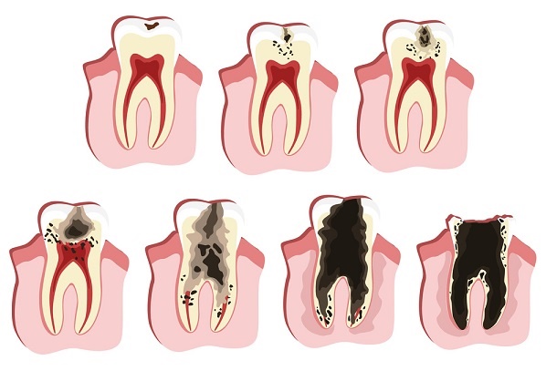 深圳杜牙根邊間好