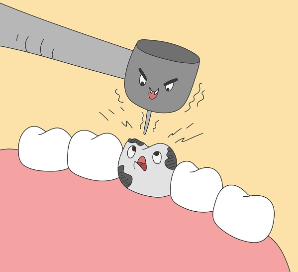 根管治疗后该做牙冠吗