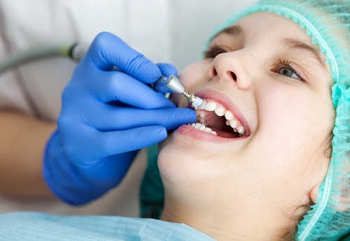 有蛀牙可以洗牙吗